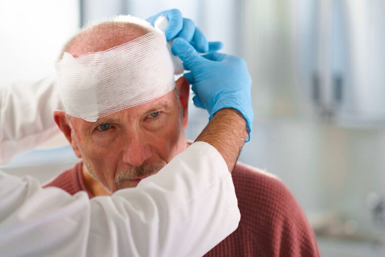 Doctor treating a head injury after an accident